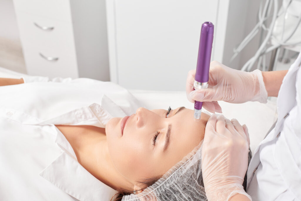 microneedling aw medspa
