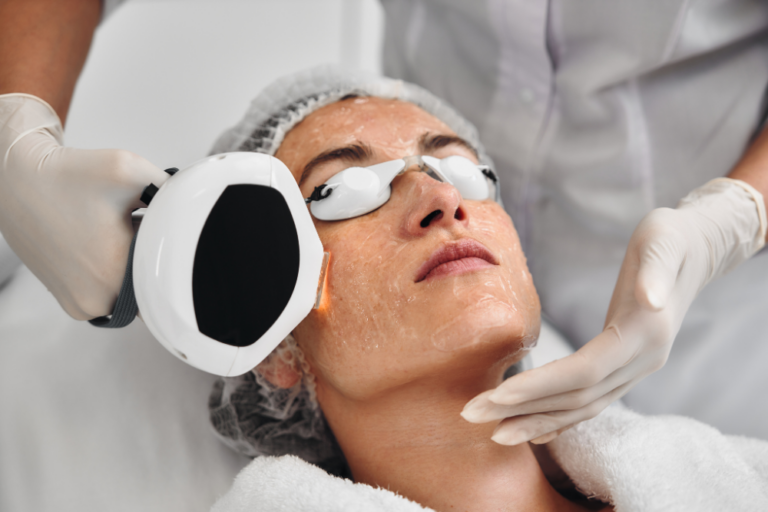 IPL Photofacial Near Me: Radiant Skin Is Just A Step Away